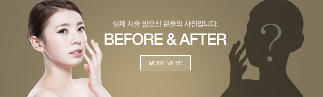 비포애프터