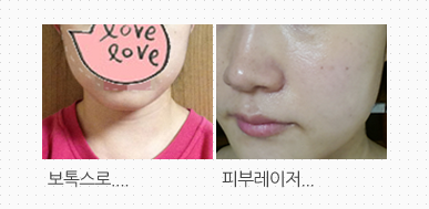 수술후기