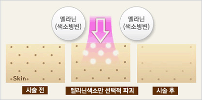 헬리오스Ⅱ